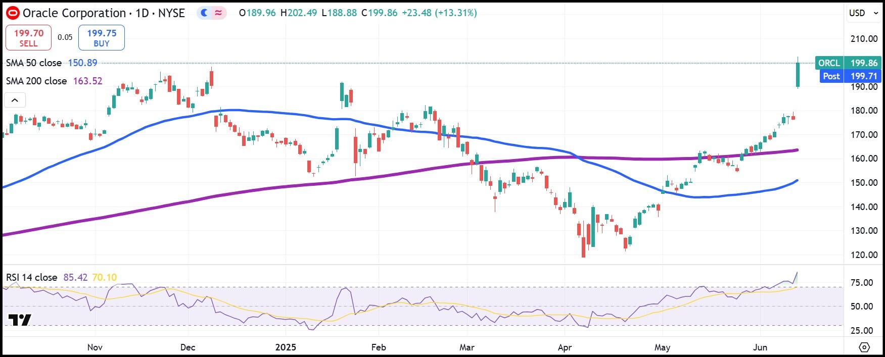 ORCL Shares Daily Chart