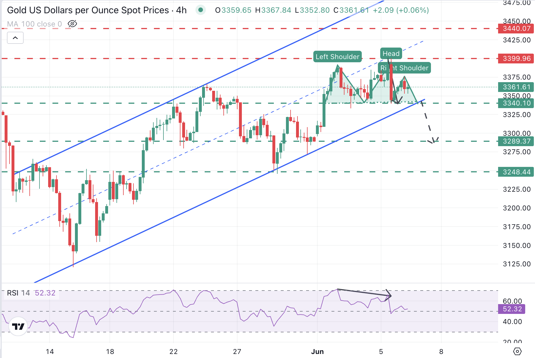 XAU/USD Chart