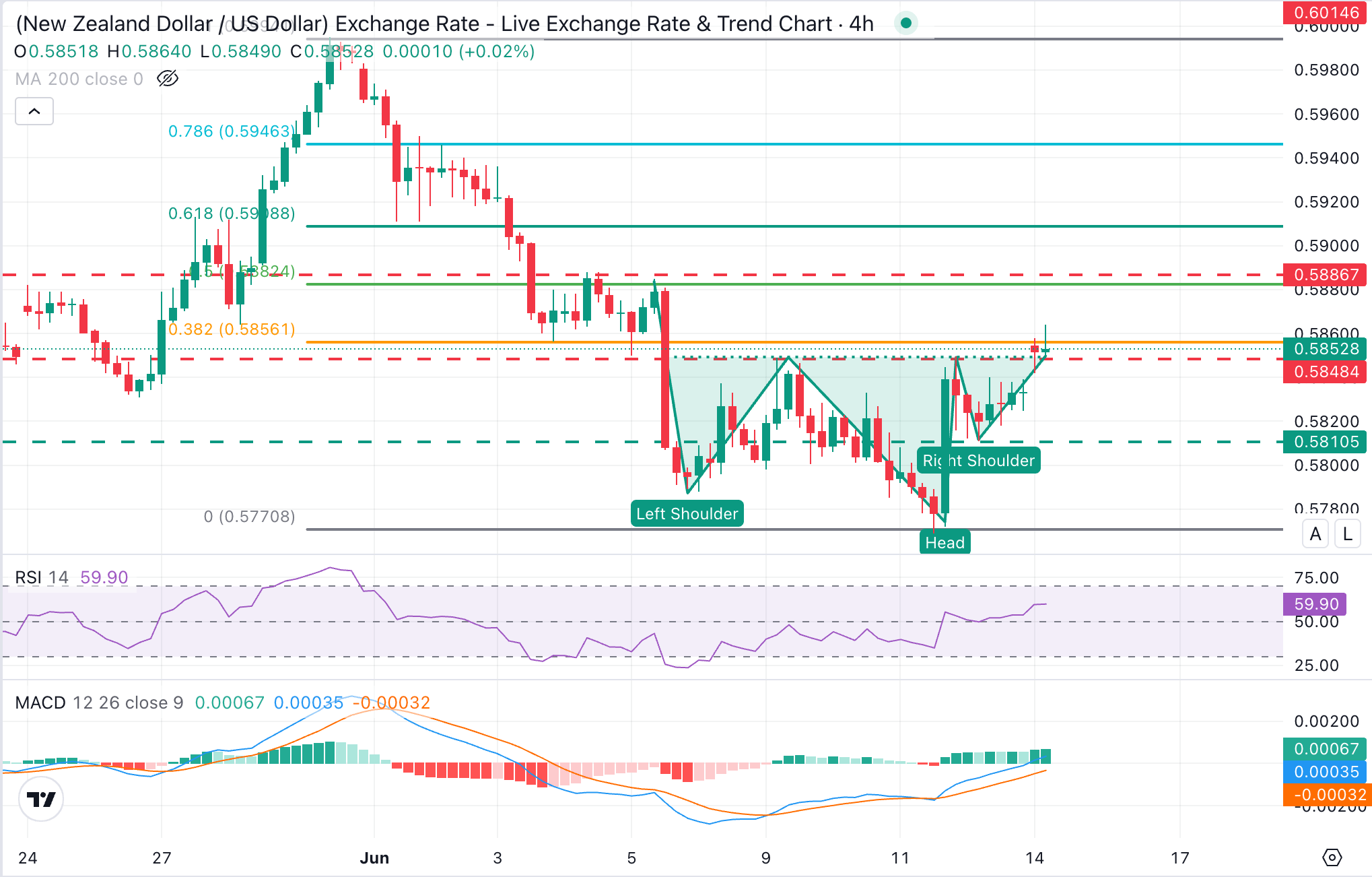 NZD/USD Chart Analysis
