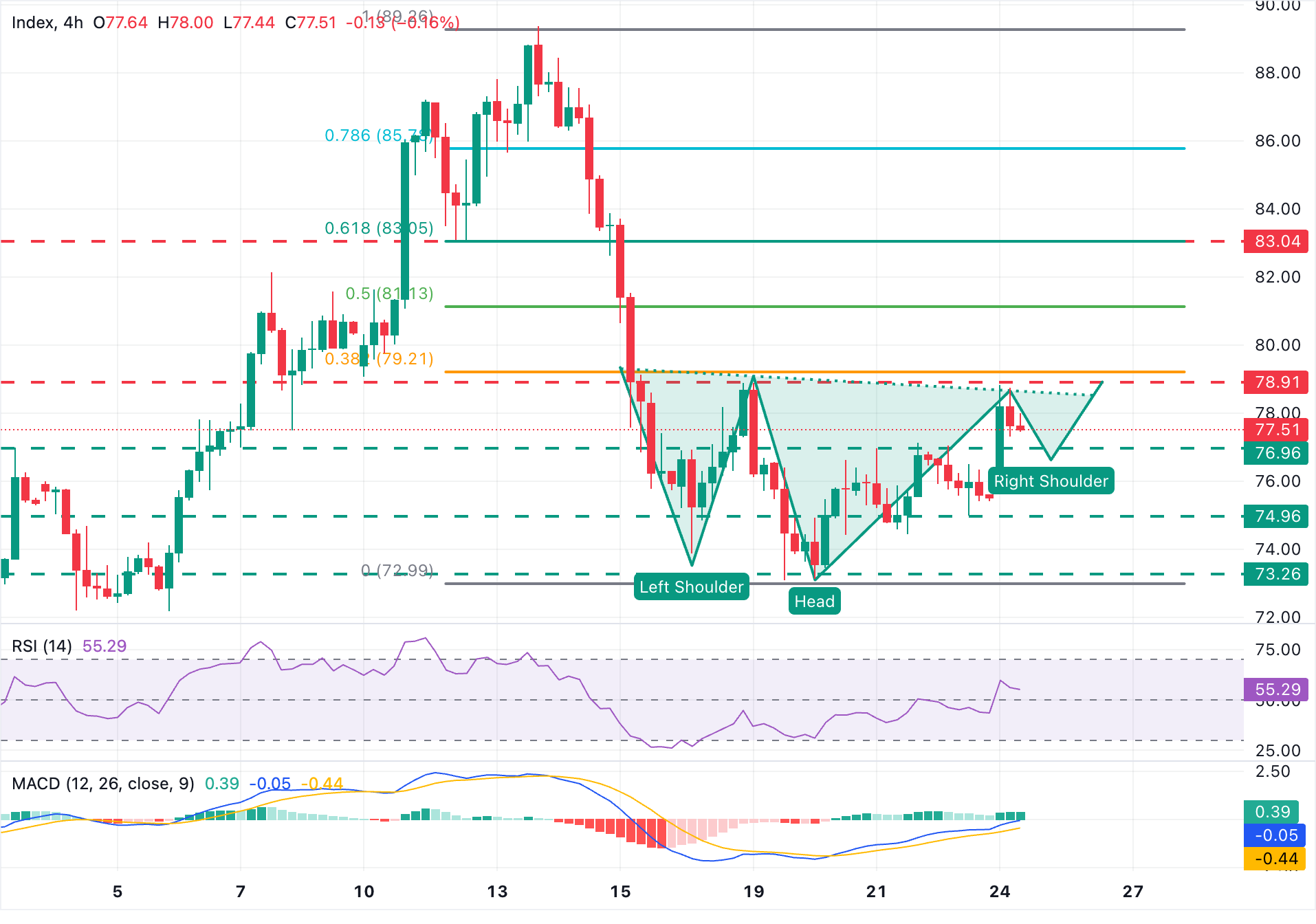 Chart Analysis XAG/USD